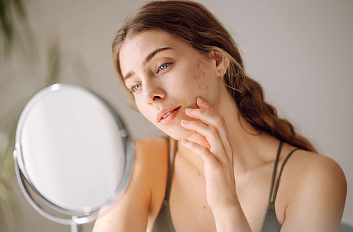  Eine junge Frau fährt mit dem Finger über hormonelle Hautveränderungen im Gesicht und schaut dabei in einen Spiegelt